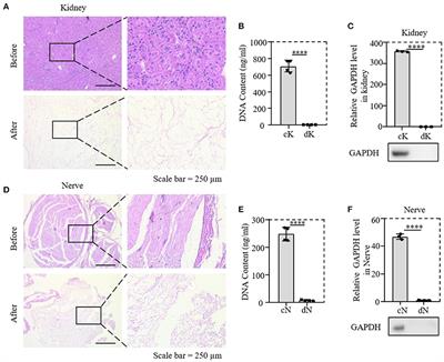 In vitro study of decellularized rat tissues for nerve regeneration